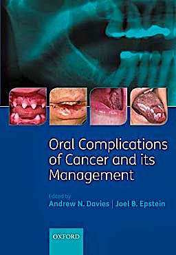 Portada del libro 9780199543588 Oral Complications of Cancer and Its Management