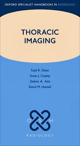 Portada del libro 9780199560479 Thoracic Imaging (Oxford Specialist Handbooks in Radiology)