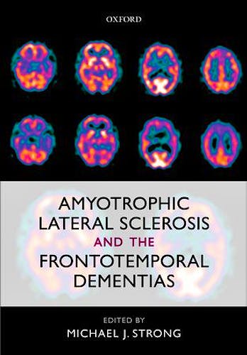 Portada del libro 9780199590674 Amyotrophic Lateral Sclerosis and the Frontotemporal Dementias