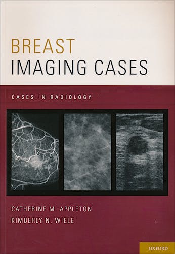 Portada del libro 9780199731923 Breast Imaging Cases. Cases in Radiology