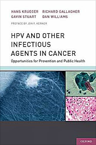 Portada del libro 9780199732913 Hpv and Other Infectious Agents in Cancer. Opportunities for Prevention and Public Health
