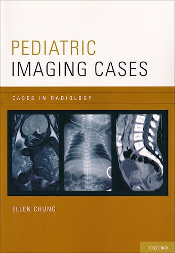 Portada del libro 9780199758968 Pediatric Imaging Cases