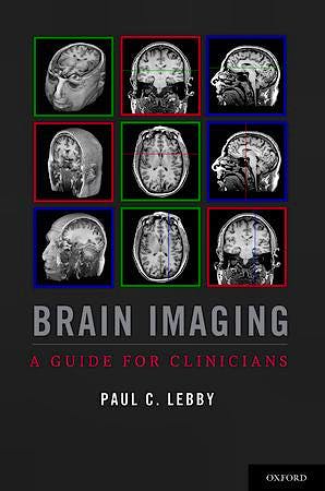 Portada del libro 9780199764679 Brain Imaging. a Guide for Clinicians