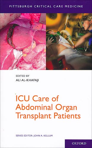Portada del libro 9780199768899 Icu Care of Abdominal Organ Transplant Patients
