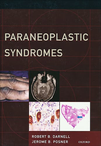 Portada del libro 9780199772735 Paraneoplastic Syndromes