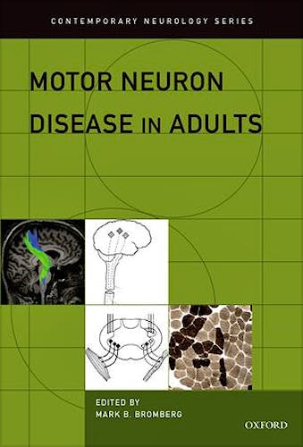 Portada del libro 9780199783113 Motor Neuron Disease in Adults (Contemporary Neurology)