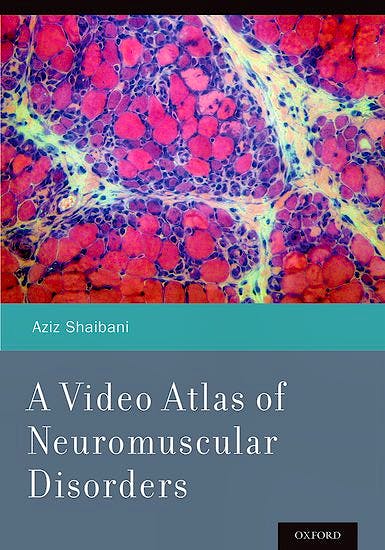 Portada del libro 9780199898152 A Video Atlas of Neuromuscular Disorders