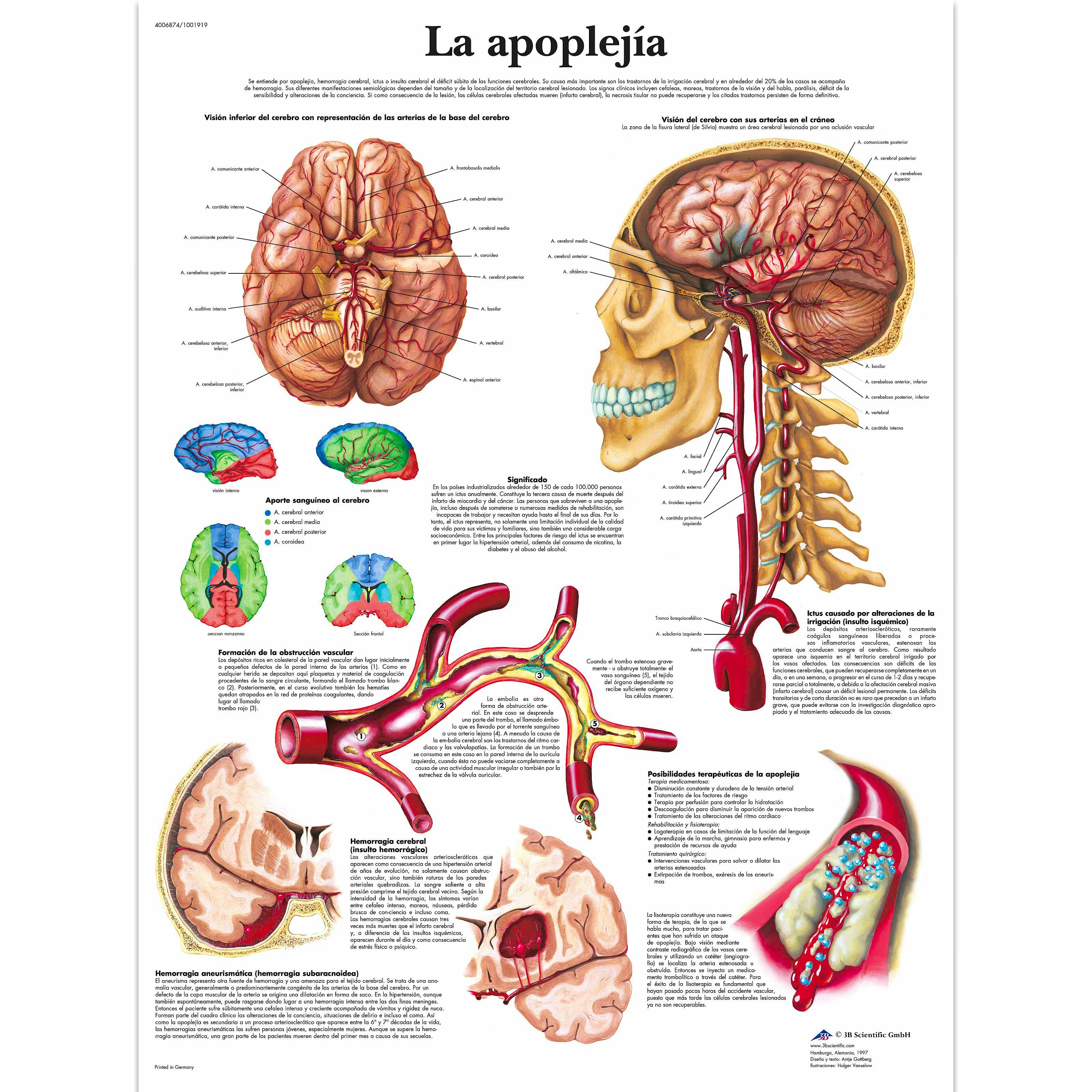 Lamina la Apoplejia (formato 50 x 67 cm)