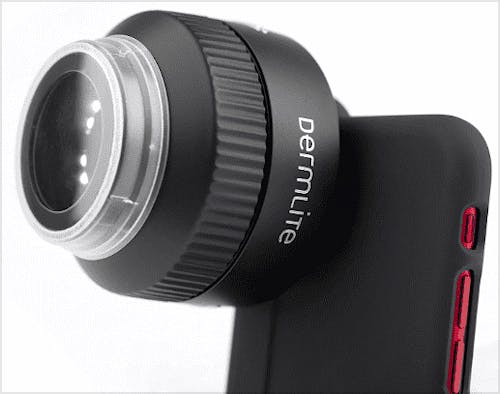 Dermatoscopio Dermlite Foto X