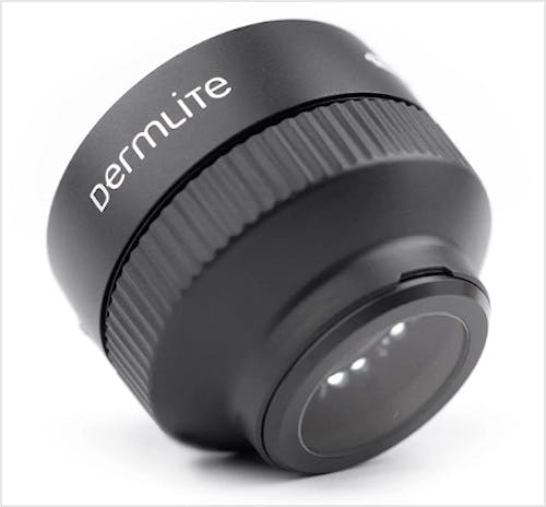 Dermatoscopio Dermlite Foto X