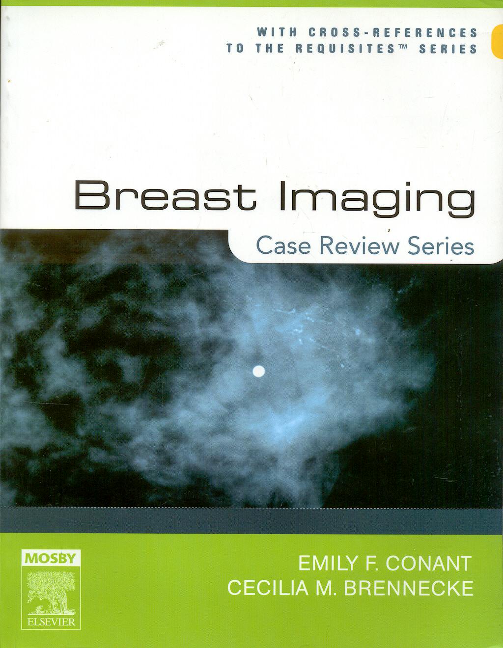 Portada del libro 9780323017466 Breast Imaging. Case Review Series