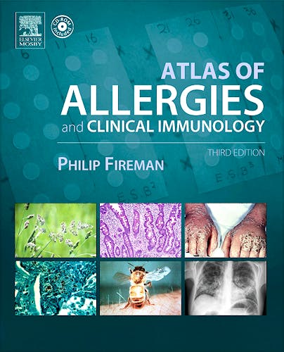 Portada del libro 9780323024952 Atlas of Allergies and Clinical Immunology