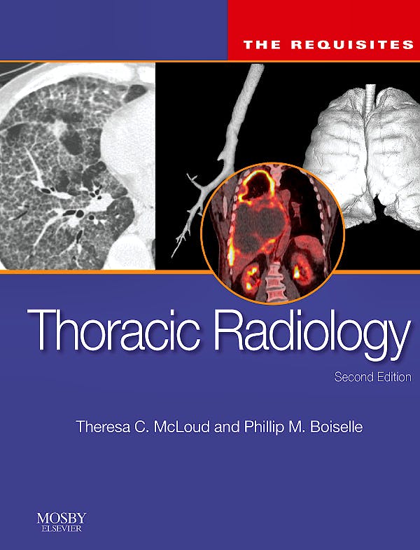 Portada del libro 9780323027908 Thoracic Radiology. the Requisites