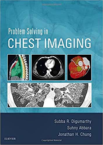 Portada del libro 9780323041324 Problem Solving in Chest Imaging (Print and Online)