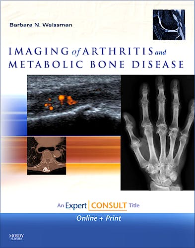 Portada del libro 9780323041775 Imaging of Arthritis and Metabolic Bone Disease