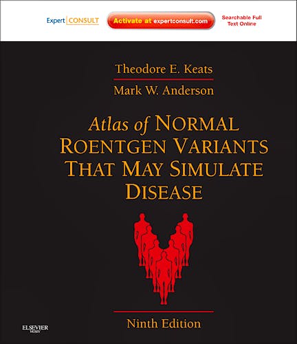 Portada del libro 9780323073554 Atlas of Normal Roentgen Variants That May Simulate Disease (Online and Print)