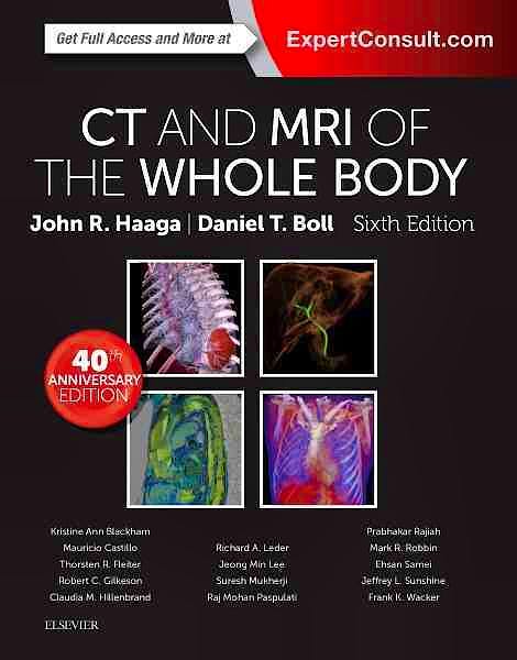 Portada del libro 9780323113281 CT and MRI of the Whole Body, 2 Vols. (Print + Online)