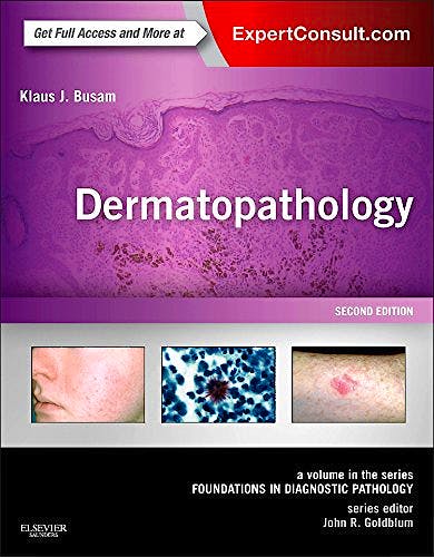 Portada del libro 9780323261913 Dermatopathology (Foundations in Diagnostic Pathology) (Print and Online)
