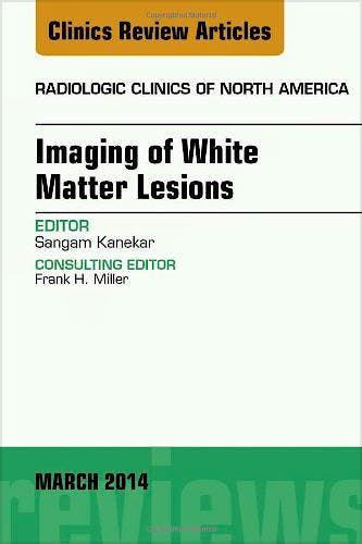 Portada del libro 9780323287203 Imaging of White Matter, an Issue of Radiologic Clinics of North America
