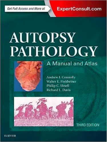 Portada del libro 9780323287807 Autopsy Pathology. A Manual and Atlas
