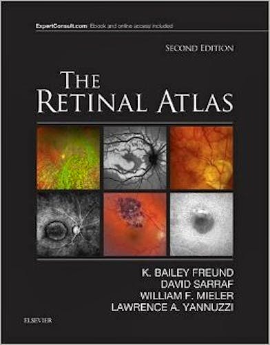 Portada del libro 9780323287920 The Retinal Atlas