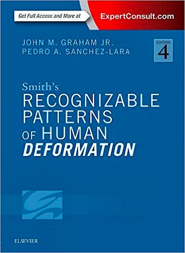 Portada del libro 9780323294942 Smith's Recognizable Patterns of Human Deformation