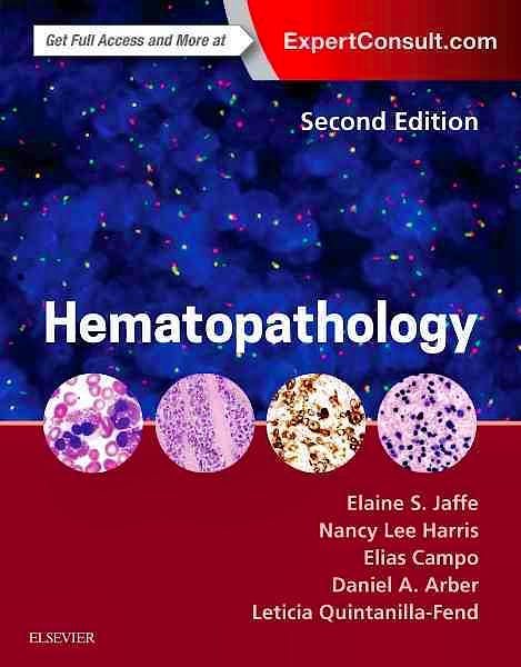 Portada del libro 9780323296137 Hematopathology (Online and Print)