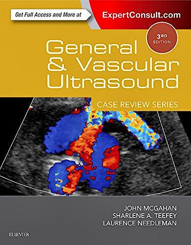 Portada del libro 9780323296144 General and Vascular Ultrasound. Case Review Series
