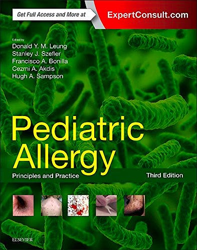 Portada del libro 9780323298759 Pediatric Allergy. Principles and Practice