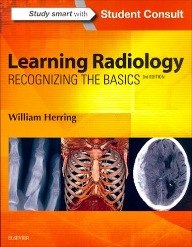 Portada del libro 9780323328074 Learning Radiology. Recognizing the Basics + Online Access