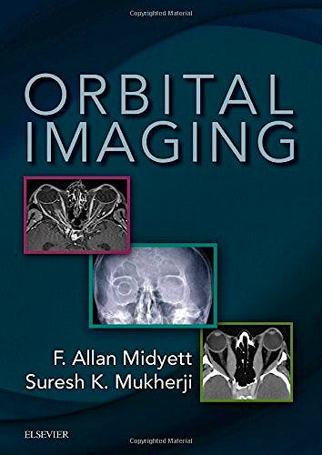 Portada del libro 9780323340373 Orbital Imaging