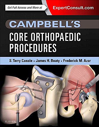 Portada del libro 9780323357630 CAMPBELL's Core Orthopaedic Procedures
