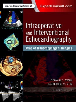 Portada del libro 9780323358255 Intraoperative and Interventional Echocardiography. Atlas of Transesophageal Imaging (Online and Print)