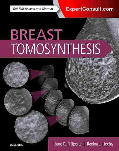 Portada del libro 9780323358279 Breast Tomosynthesis (Online and Print)