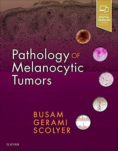 Portada del libro 9780323374576 Pathology of Melanocytic Tumors