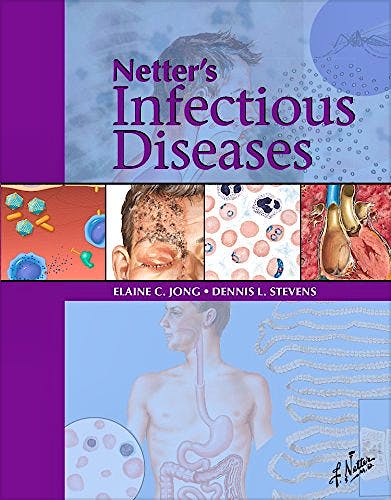Portada del libro 9780323374743 Netter's Infectious Disease