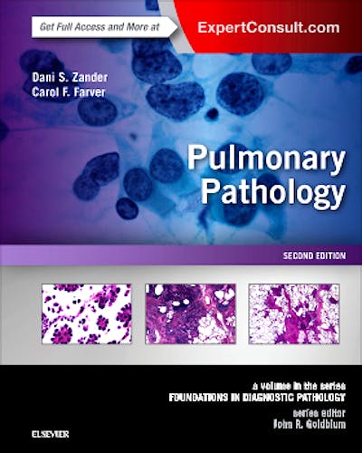 Portada del libro 9780323393089 Pulmonary Pathology. A Volume in the Series Foundations in Diagnostic Pathology