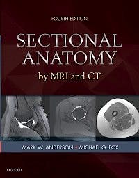 Portada del libro 9780323394192 Sectional Anatomy by MRI and CT (Online and Print)