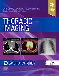Portada del libro 9780323428798 Thoracic Imaging. Case Review Series
