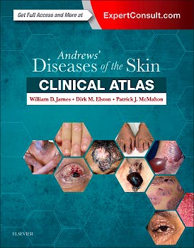 Portada del libro 9780323441964 Andrews' Diseases of the Skin Clinical Atlas (Online and Print)
