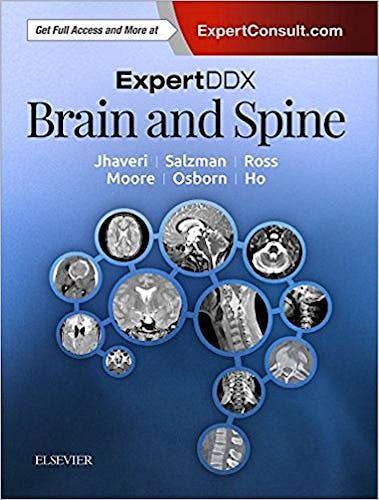 Portada del libro 9780323443081 Expert DDX: Brain and Spine (Print and Online)