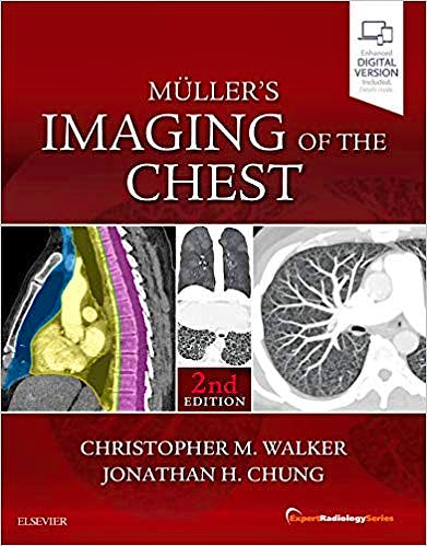 Portada del libro 9780323462259 Müller's Imaging of the Chest (Expert Radiology Series) (Print and Online)