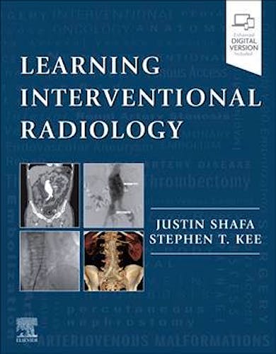 Portada del libro 9780323478793 Learning Interventional Radiology (Print and Online)