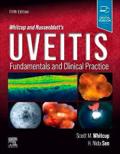 Portada del libro 9780323480147 Whitcup and Nussenblatt's Uveitis. Fundamentals and Clinical Practice