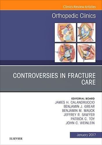 Portada del libro 9780323482653 Controversies in Fracture Care, an Issue of Orthopedic Clinics, Vol. 48-1