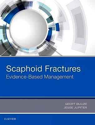 Portada del libro 9780323485647 Scaphoid Fractures. Evidence-Based Management