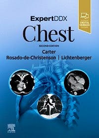 Portada del libro 9780323524827 Expert DDX: Chest (Print + Online)