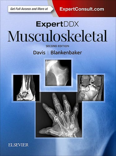 Portada del libro 9780323524834 Expert DDX: Musculoskeletal (Print and Online)