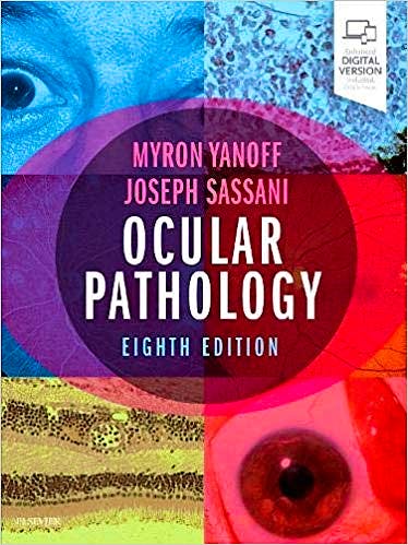 Portada del libro 9780323547550 Ocular Pathology (Print + Online)