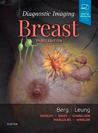 Portada del libro 9780323548120 Diagnostic Imaging. Breast